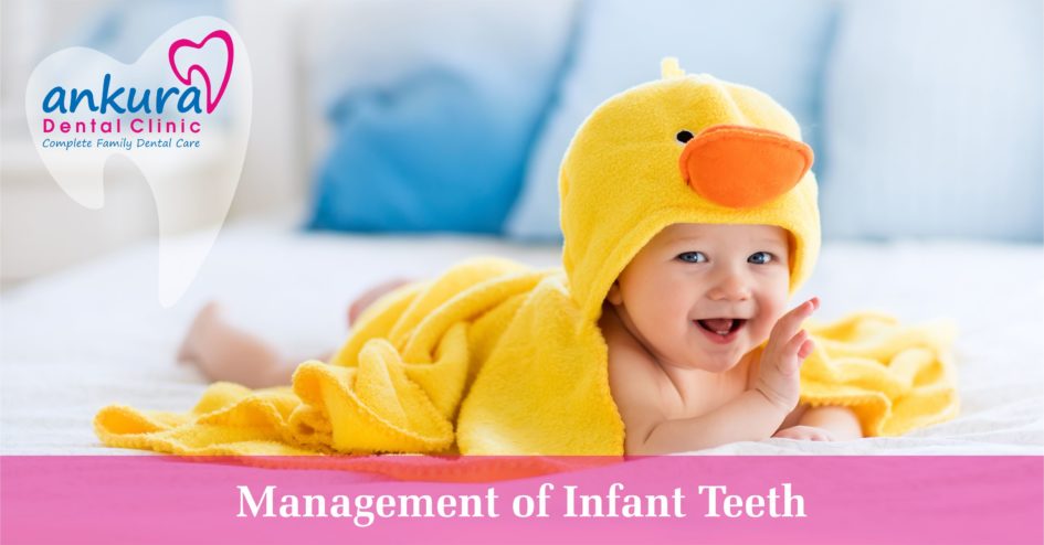 Management of Infant Teeth