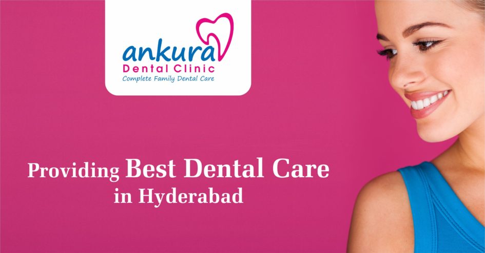 Providing Best dental Care in Hyderabad