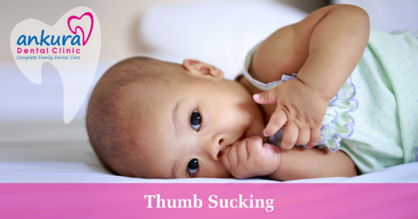 Thumb Sucking in Children - An Insight on The Consequences