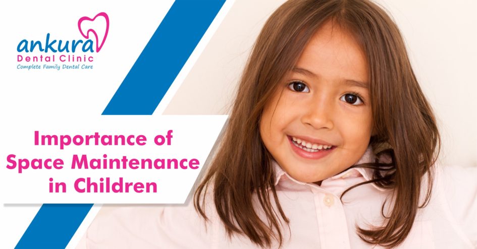 Importance Of Space Maintenance In Children