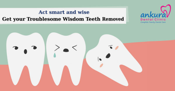 Get Your Troublesome Wisdom Teeth Removed